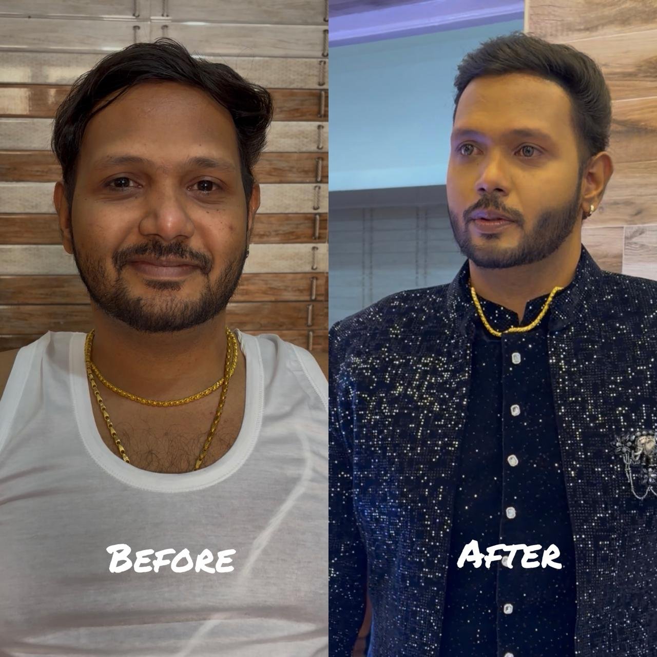 Groom Makeup Before After Chennai